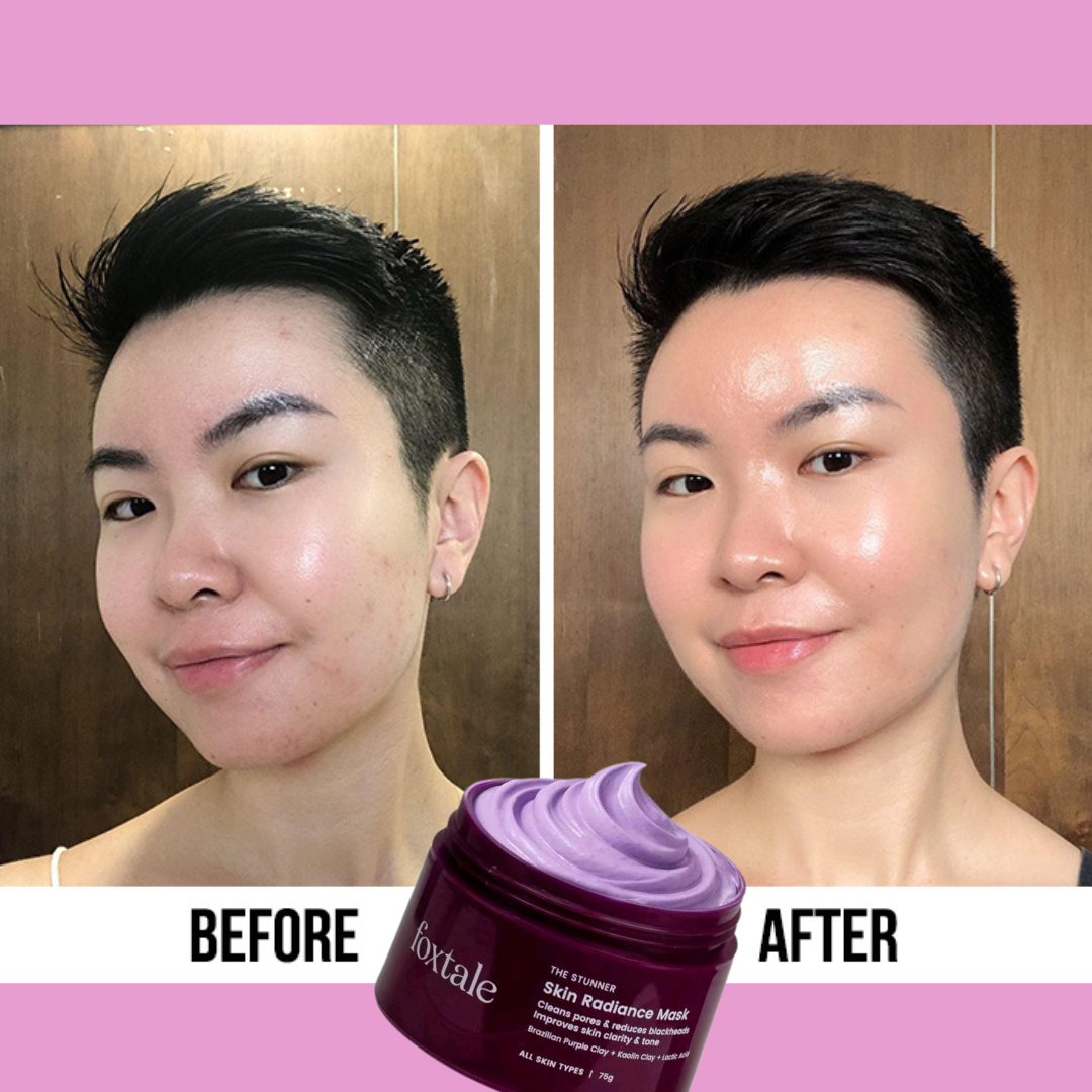 Purple Clay Mask - Removes tan + Removes blackheads + Brightens skin at just 1st use.
