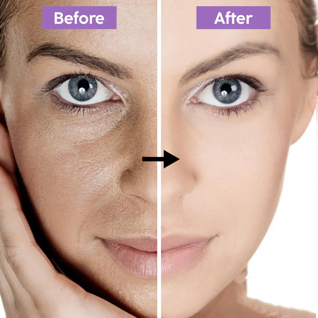 Purple Clay Mask - Removes tan + Removes blackheads + Brightens skin at just 1st use.