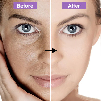 Purple Clay Mask - Removes tan + Removes blackheads + Brightens skin at just 1st use.